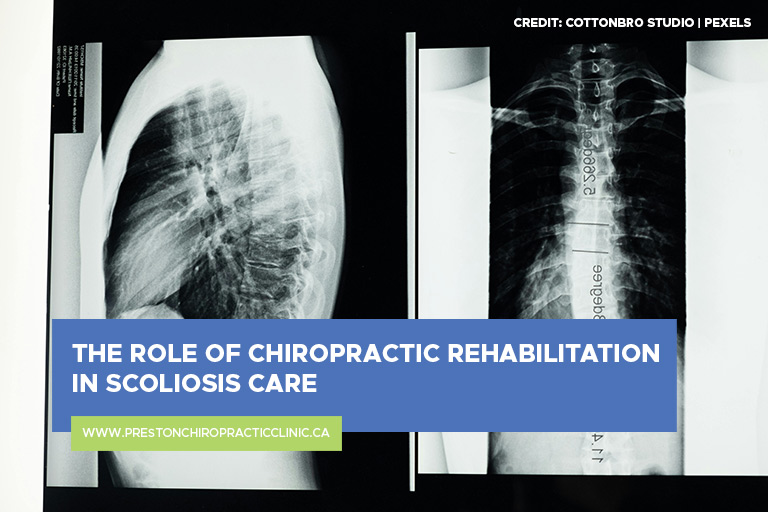 The Role of Chiropractic Rehabilitation in Scoliosis Care